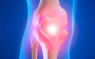 Causas da artrose na articulación do xeonllo