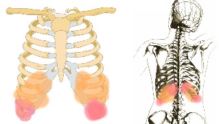 dor de costas baixo costelas síntomas
